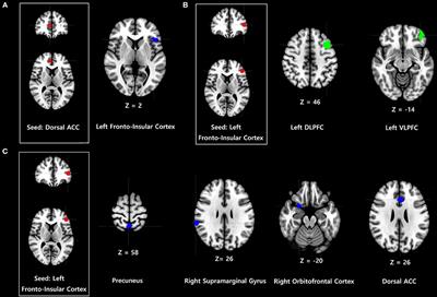 Altered Functional Connectivity of the Salience Network in Problematic Smartphone Users